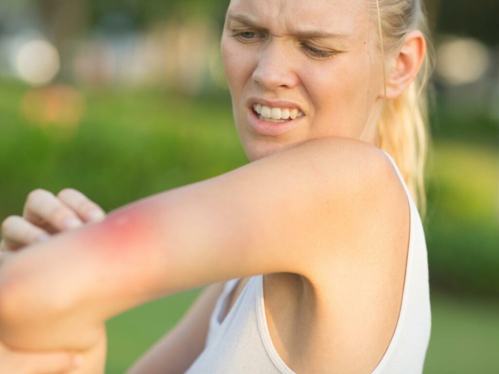 A woman upset with bug bite on her arm.