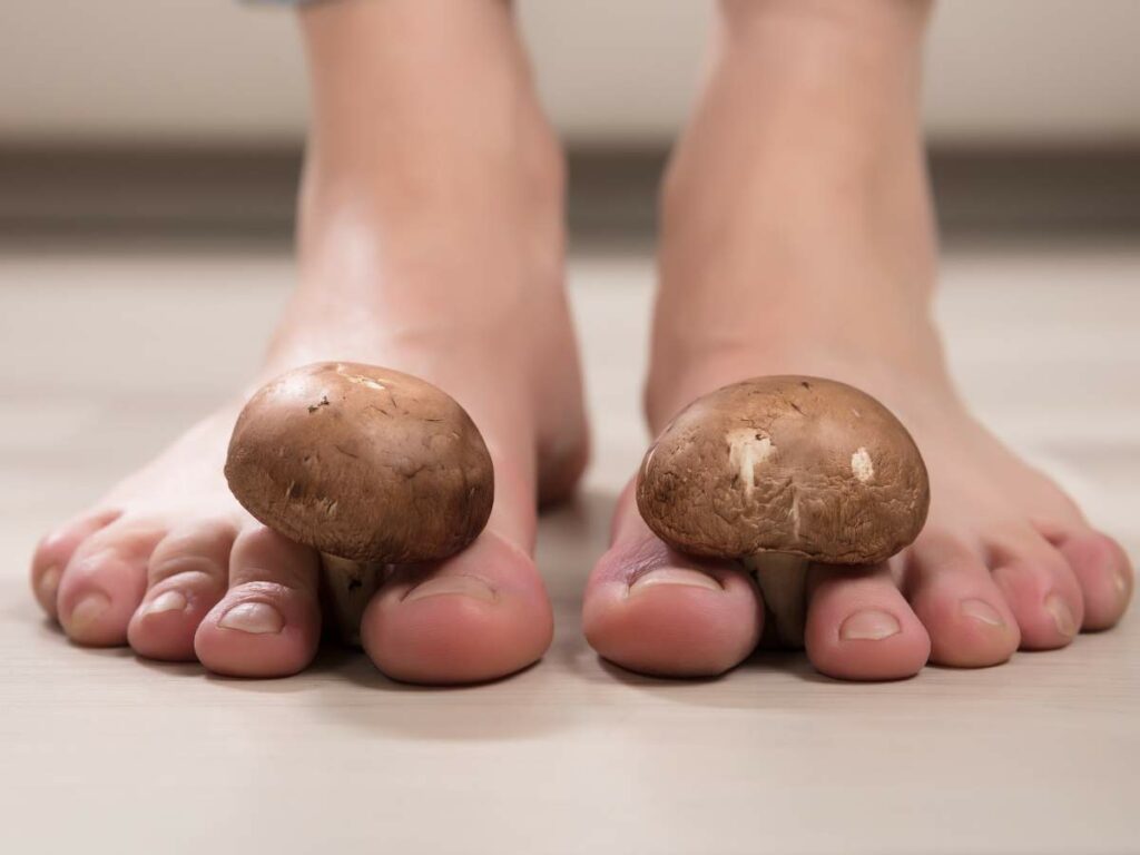A woman's feet with two mushrooms on them.