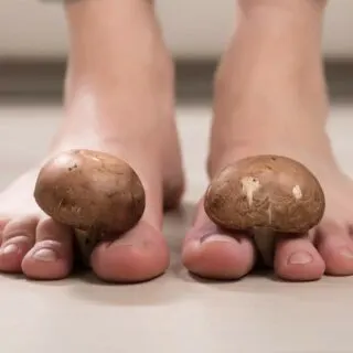 A woman's feet with two mushrooms on them.